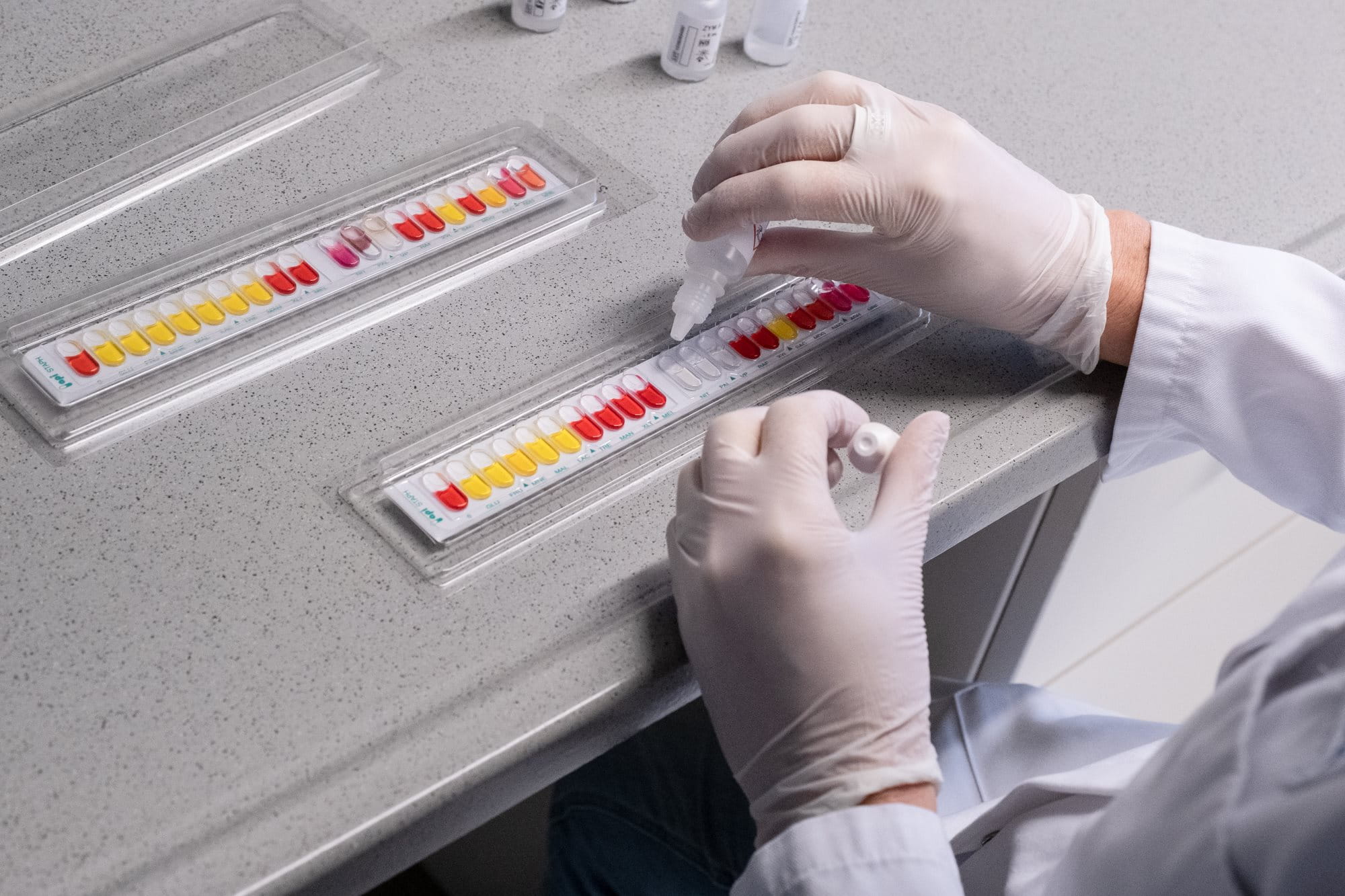 Gloved hands arranging pH indicator strips on a laboratory bench, preparing samples for chemical analysis.