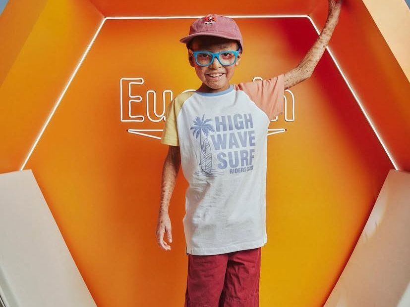 A boy standing in an orange exhibition cube branded Eucerin, raising one arm, with visible skin differences on the arm and legs.