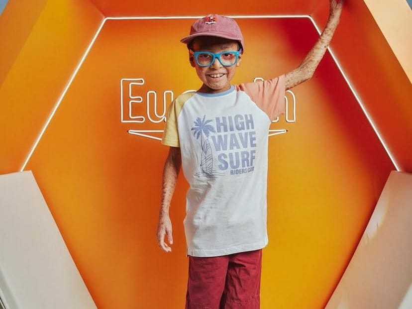 A boy standing in an orange exhibition cube branded Eucerin, raising one arm, with visible skin differences on the arm and legs.